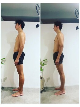 エイジングケアサロン 青山 本店/【メンズ】ビフォア・アフター