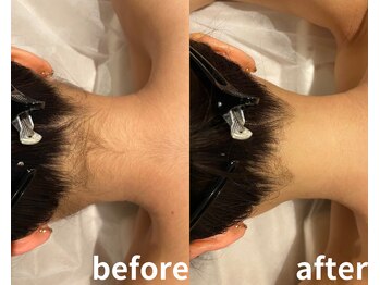 サロントット(salon totto)/before→after