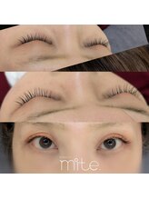 ミテ(mite.)/100本イメージ