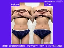 フェレザ 新潟(Felleza)/運動や食事のご提案も♪