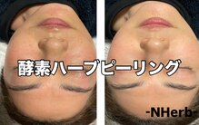 エヌハーブ(NHerb)
