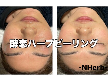 エヌハーブ(NHerb)の写真