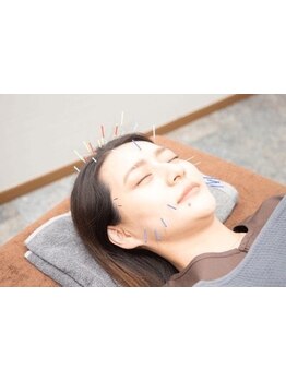 鍼灸施術を受けたい