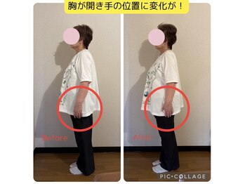 ベルフルール(Belle Fleur)/フェムケア矯正