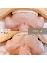 サロン ヴィプラス(SALON Vi+)/バストケア5回目