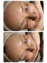 リボーン(be reborn)/艶やかな水光肌に☆