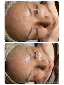 リボーン(be reborn)/艶やかな水光肌に☆