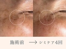 レイミー(reimee)