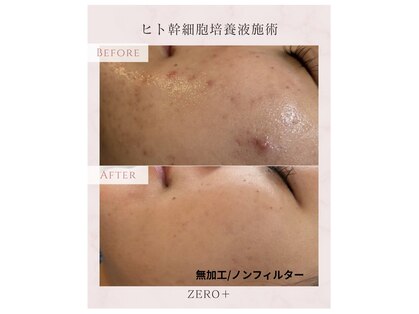 ゼロプラス(ZERO+)の写真