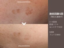 アンドアンド(&and)/大きなシミにも！