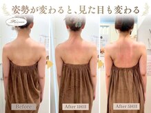 ロココ 横浜店(Rococo)の雰囲気(バストアップと同時に根本である姿勢も改善してスタイルアップ♪)