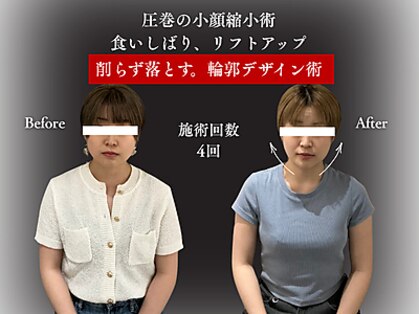 整体と美容鍼 無名の写真