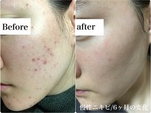 コマ(KOMA)の雰囲気(丁寧なカウンセリングで、初めての方でも安心♪)