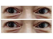 ネオビューティー(Neo beauty)/~フラットラッシュ100~