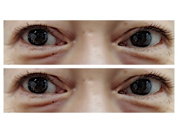 ネオビューティー(Neo beauty)/~フラットラッシュ100~