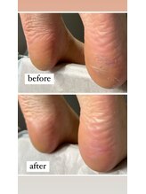 ビンナ 五反田店(Binna)/足裏角質自分で削らないで！