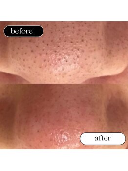 トータルビューティーサロンリア(Li'a)/ビフォー＆アフター
