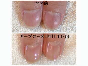 ココモ(cocomo)/深爪長さだしフィルイン自爪育成