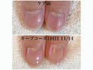 キープコースで美爪を継続！
