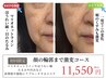 初回限定【-5歳肌たるみ引き上げEMS付エステ】表情筋・脂肪×EMS85分11550円