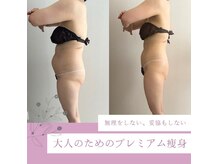 ティターニア(Titania)
