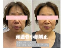サロンドグレース(Salon de Grace)の雰囲気（やればやるほど変わる、身体、頭蓋骨、小顔矯正）