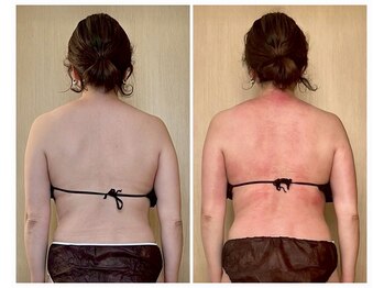 ココア(CoCoa)/活性リンパ洗浄