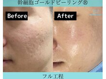 リメイククリニカルビューティー(Remake clinical beauty)/