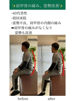 オルカ整体院(ORCA整体院)/【鹿児島/肩こり】