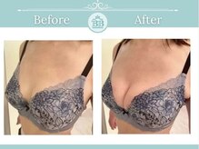 美人バスト 岡山店の雰囲気（育乳のプロが育たない原因を徹底解明★バストアップは叶えられる）