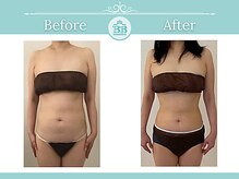美人バスト 辻堂店/バストを残してダイエット