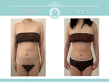 美人バスト 辻堂店/バストを残してダイエット