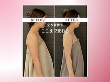 リスブランビューティー(Lys Blanc Beauty)/２週ペース４回の変化