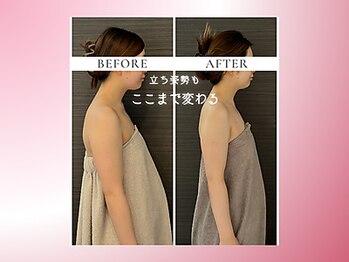 リスブランビューティー(Lys Blanc Beauty)/２週ペース４回の変化