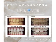 ホワイトニングショップ 阪急伊丹店の雰囲気（まずは無料カウンセリング！お客様それぞれの悩みを解消します☆）