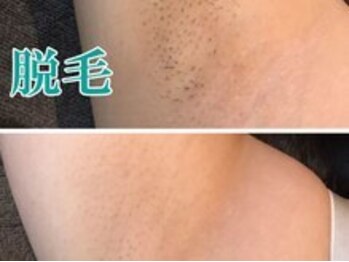 レディース ビホウ(BIHOU)/