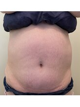 リフティングラボ(LIFTING LAB)/