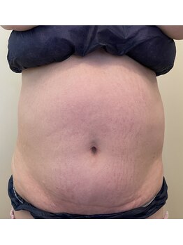 リフティングラボ(LIFTING LAB)/