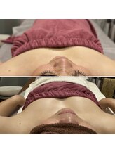 アンベリール(Embellir)/ボンボンバスト