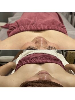 アンベリール(Embellir)/ボンボンバスト