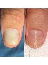 ウェルズユキ(well's yuki)/自爪ケアサロン/美爪育成