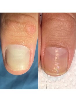 ウェルズユキ(well's yuki)/自爪ケアサロン/美爪育成