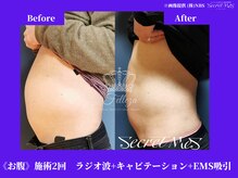 フェレザ 新潟(Felleza)/EMS-電気刺激