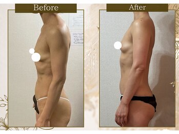 マリン(MARINE)/1年８ヶ月でここまで変わる♪