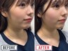 【NEW☆】ちょっと痛いけどハマる♪小顔コルギ3,980円◎男性もOK！　