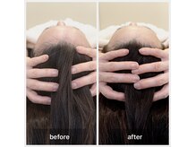 オルネ(ORNE.)の雰囲気（脳疲労に着目し自律神経を整える究極のヘッドマッサージ美顔調整）