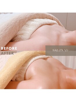 サロン ヴィプラス(SALON Vi+)/バストケア7回目