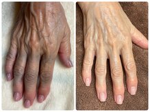 ココネイル(coco.nail)/STOP老化！手肌のケア