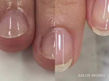 モアナリゾート エルア(moana Resort 'elua)の写真/資格者による自爪育成コース☆美爪ケアに必須なネイルオイルのプレゼント付♪深爪/薄爪/形などのお悩みに◎
