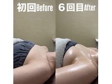 オンユ(Onyu)/ビフォーアフター9